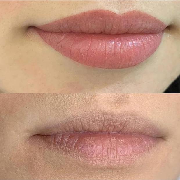 Lèvres avant et après dermopigmentation