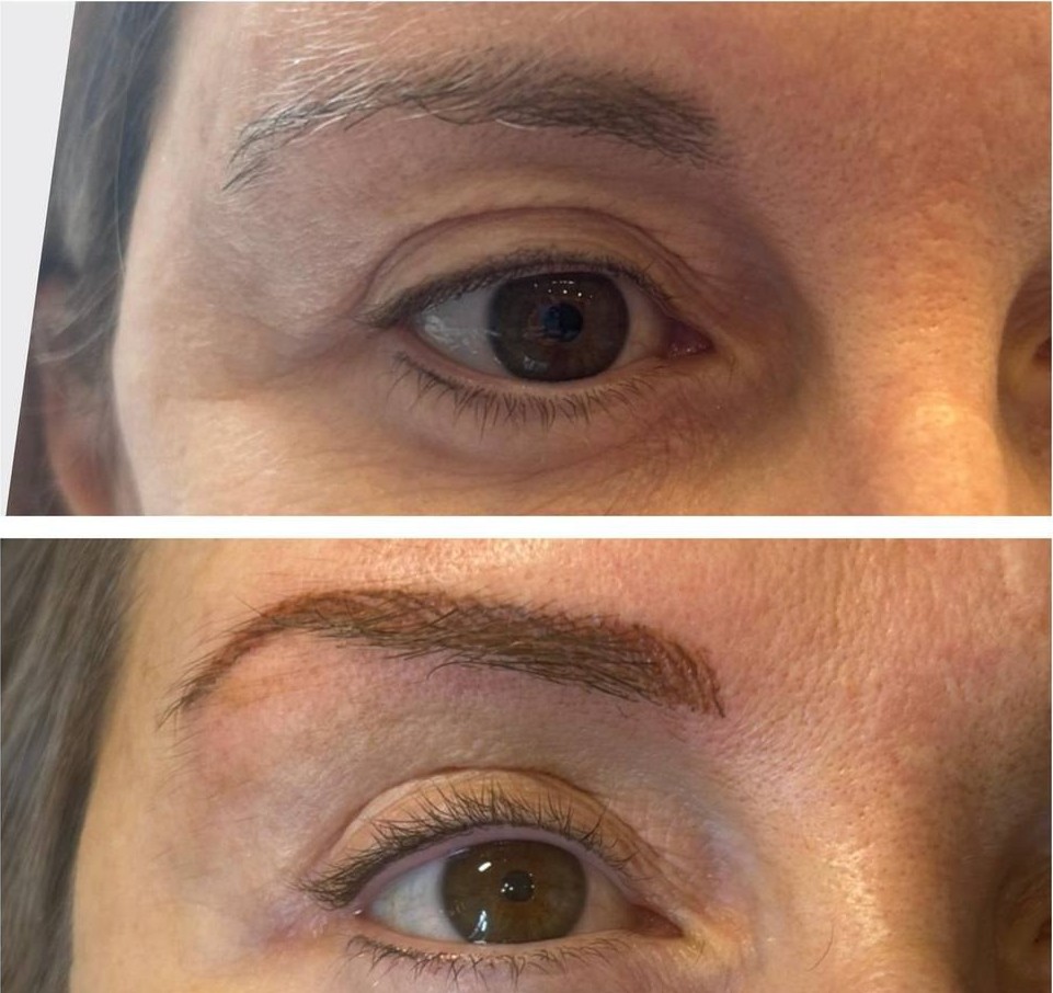 Sourcils redessinés, avant et après