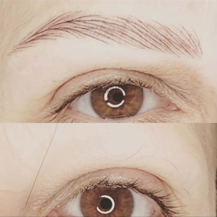 Sourcils recréés en trompe-l'œil après chimiothérapie, avant et après